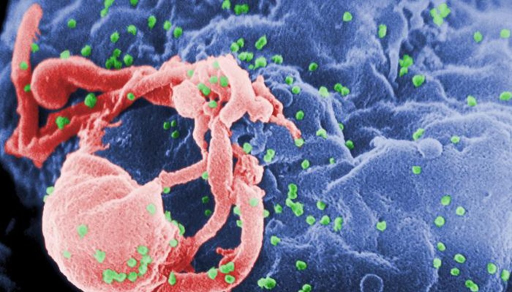 A scanning electron micrograph of HIV virons emerging from a white blood cell. (CDC)
