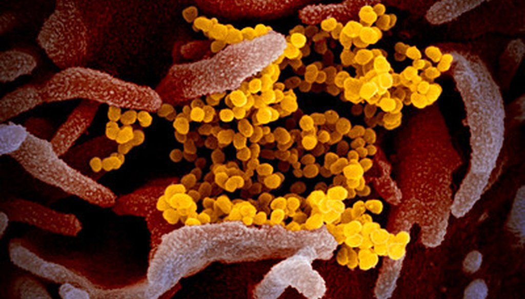 This electron microscope image shows the Novel Coronavirus SARS-CoV-2 (yellow) emerging from the surface of cells (pink). (Credit: NIAID)