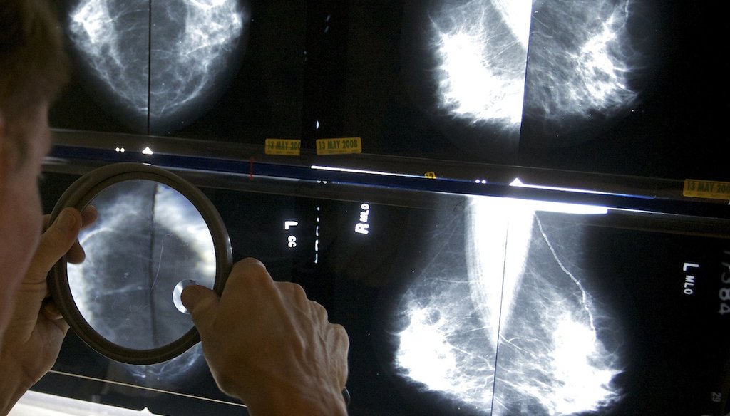 A radiologist checks mammograms for breast cancer in Los Angeles on May 6, 2010. (AP)