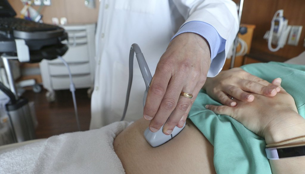 A doctor performs an ultrasound scan on a pregnant woman on Aug. 7, 2018, at a hospital in Chicago. (AP)