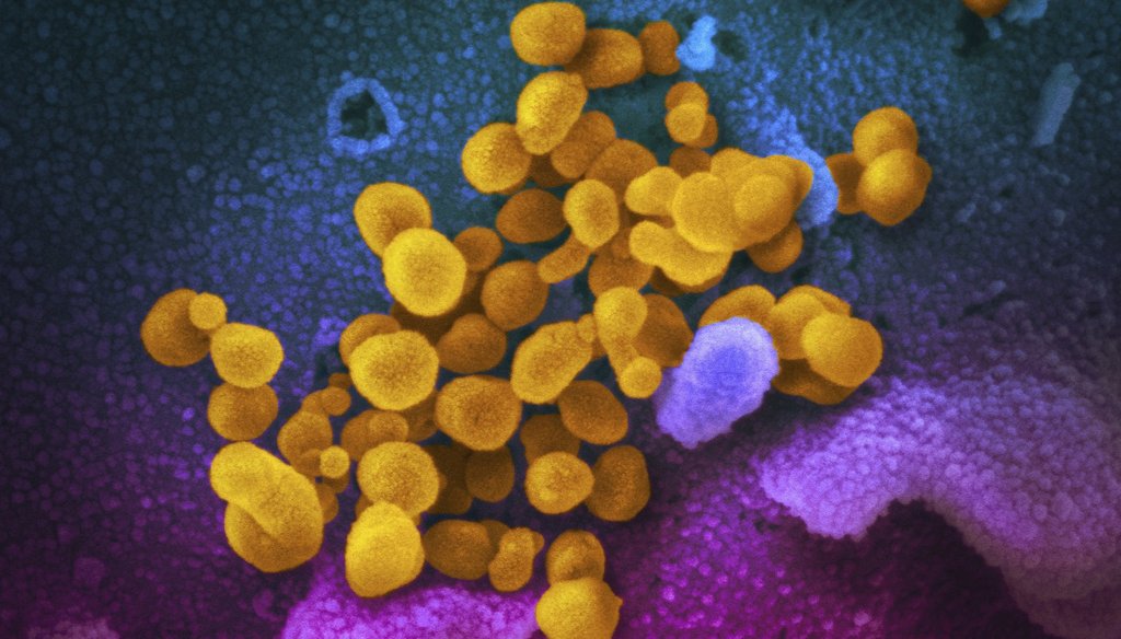 This undated electron microscope image made available by the U.S. National Institutes of Health in February 2020 shows the Novel Coronavirus SARS-CoV-2, yellow, emerging from the surface of cells, blue/pink, cultured in the lab. (NIAID-RML via AP)