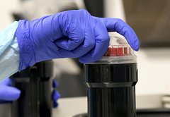 Ask PolitiFact: Do you have to get the vaccine if you’ve had COVID-19?