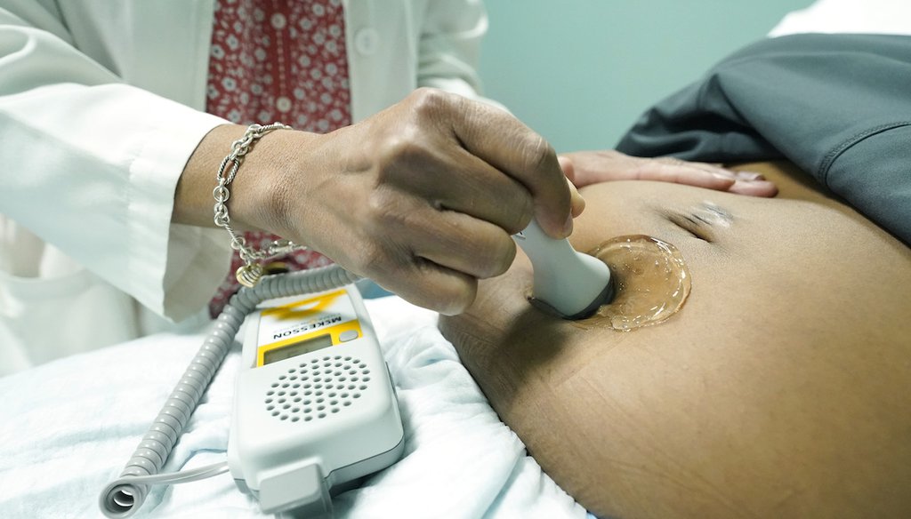 Dr. Felecia Brown, a midwife at Sisters in Birth, a Jackson, Miss., clinic that serves pregnant women, left, uses a hand held doppler probe on Kamiko Farris of Yazoo City, to measure the heartbeat of the fetus, Dec. 17, 2021. (AP)