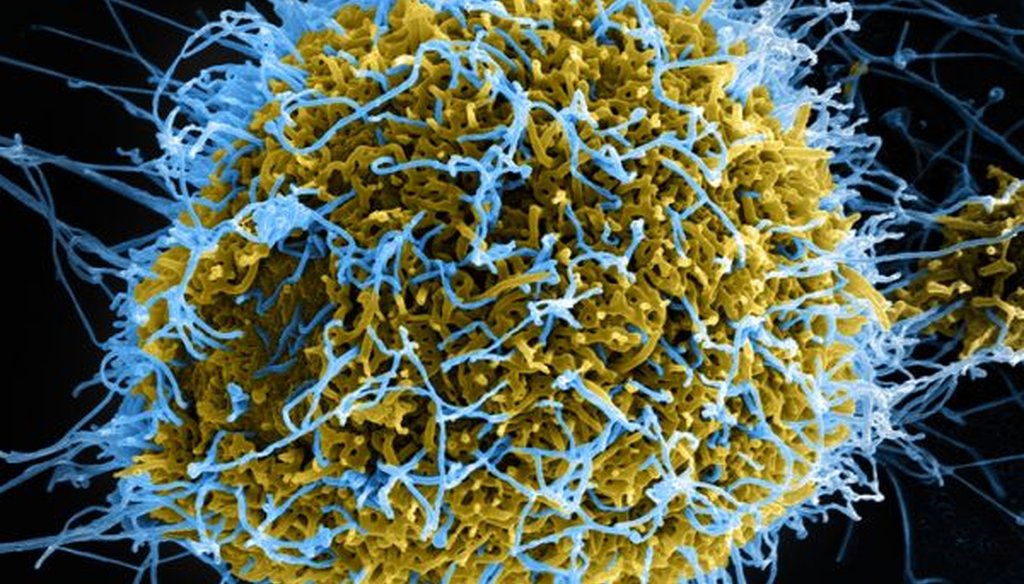 A colorized scanning electron micrograph of filamentous Ebola virus particles (in blue) budding from a infected cell (yellow-green). (National Institute of Allergy and Infectious Disease)