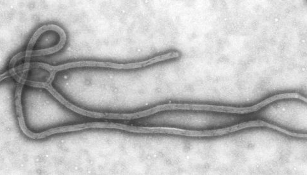 A micrograph of the Ebola virus. (Centers for Disease Control and Prevention)