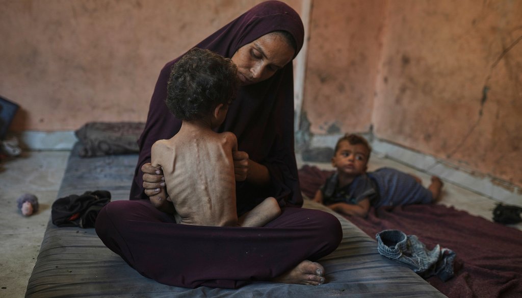 Naima Abu Ful poses for a photo with her 2-year-old malnourished child, Yazan, at their home in the Shati refugee camp in Gaza City, Wednesday, July 23, 2025. (AP)