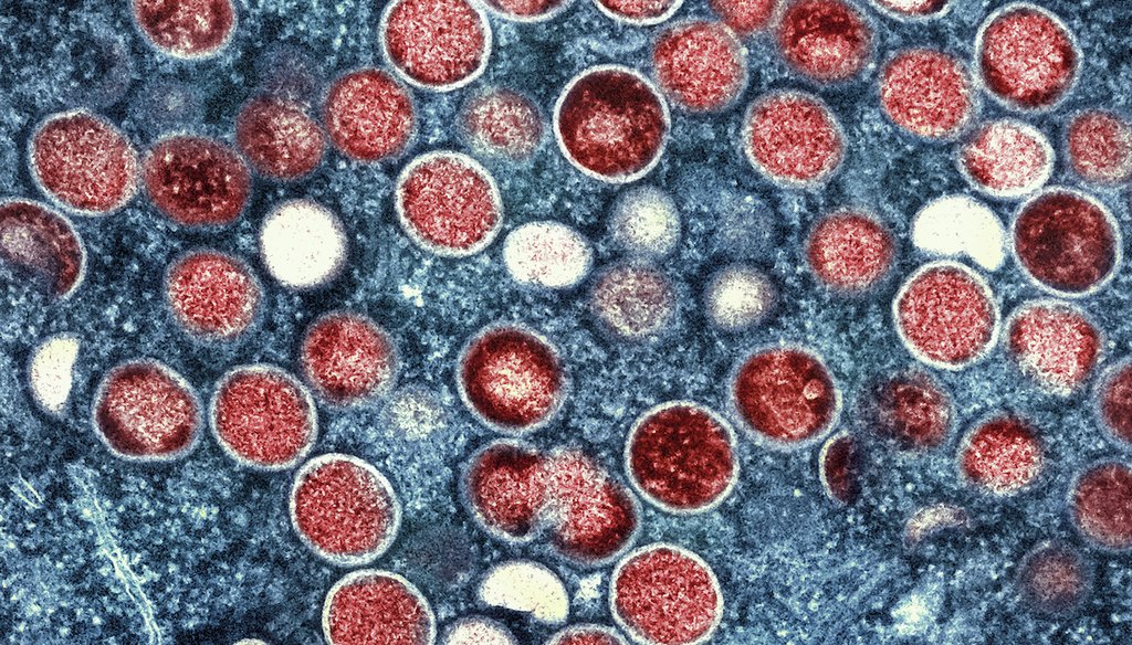 This image provided by the National Institute of Allergy and Infectious Diseases shows a colorized transmission electron micrograph of monkeypox particles (red) found within an infected cell (blue). (NIAID via AP)