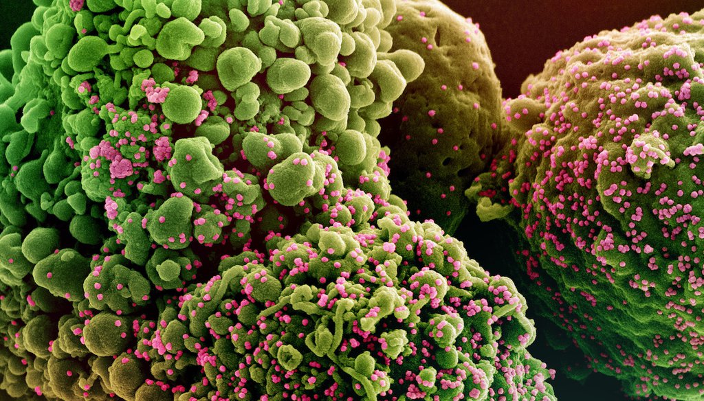 Colorized scanning electron micrograph of a cell infected with the omicron strain of SARS-CoV-2 virus particles (pink), isolated from a patient sample. (National Institute of Allergy and Infectious Diseases)