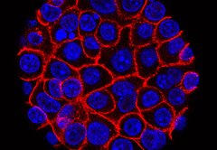 A clinical trial shows a pill almost doubled survival for pancreatic cancer patients. Now what?