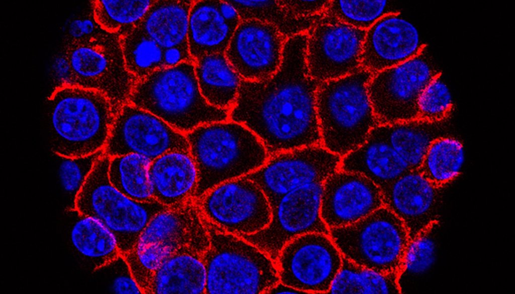 This undated microscope image from USC via the NIH shows pancreatic cancer cells, nuclei in blue, growing as a sphere encased in membranes, red. (AP)