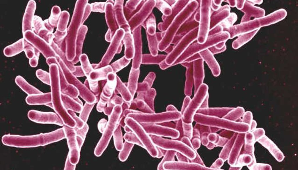 A scanning electron micrograph of the mycobacterium tuberculosis bacteria, which causes TB. (NIAID)