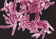 Tuberculosis: A PolitiFact Sheet