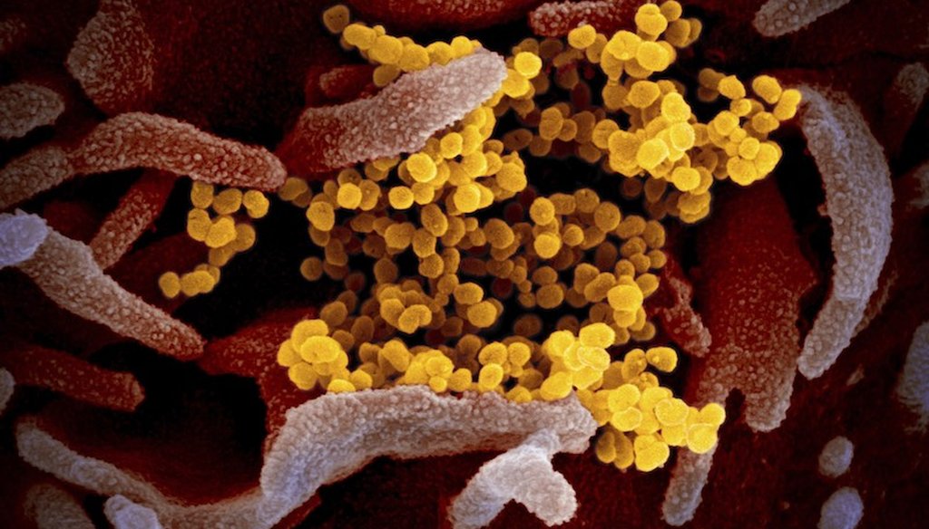 This microscope image shows SARS-CoV-2 (yellow)—also known as 2019-nCoV, the virus that causes COVID-19. (Credit: NIAID-RML)