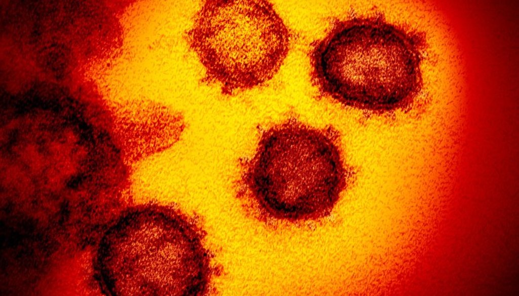This undated electron microscope image made available by the U.S. National Institutes of Health in February 2020 shows the Novel Coronavirus SARS-CoV-2.