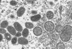 Monkeypox outbreak: What to know about its spread, symptoms and vaccines