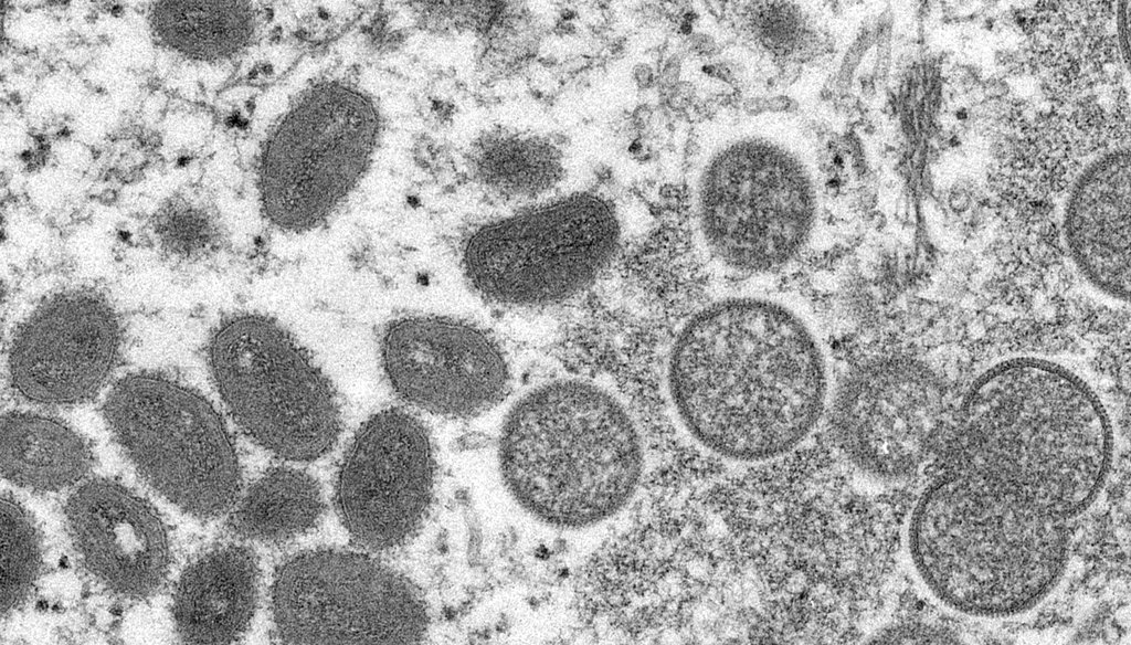 This 2003 electron microscope image from the CDC shows mature, oval-shaped monkeypox virions, left, and spherical immature virions, right, obtained from a sample of human skin associated with the prairie dog outbreak in the U.S.