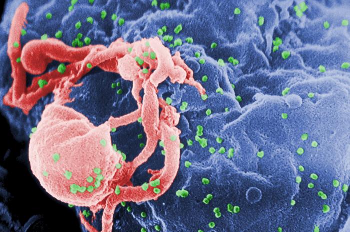 A scanning electron micrograph of HIV virons emerging from a white blood cell. (CDC)